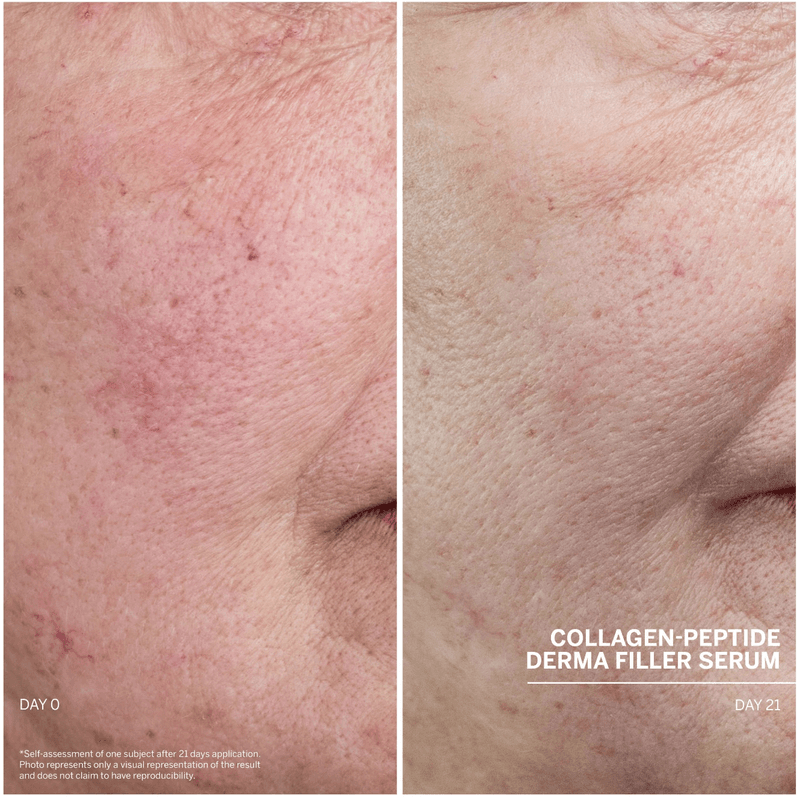 Doctor Babor Lifting Derma Filler Serum 